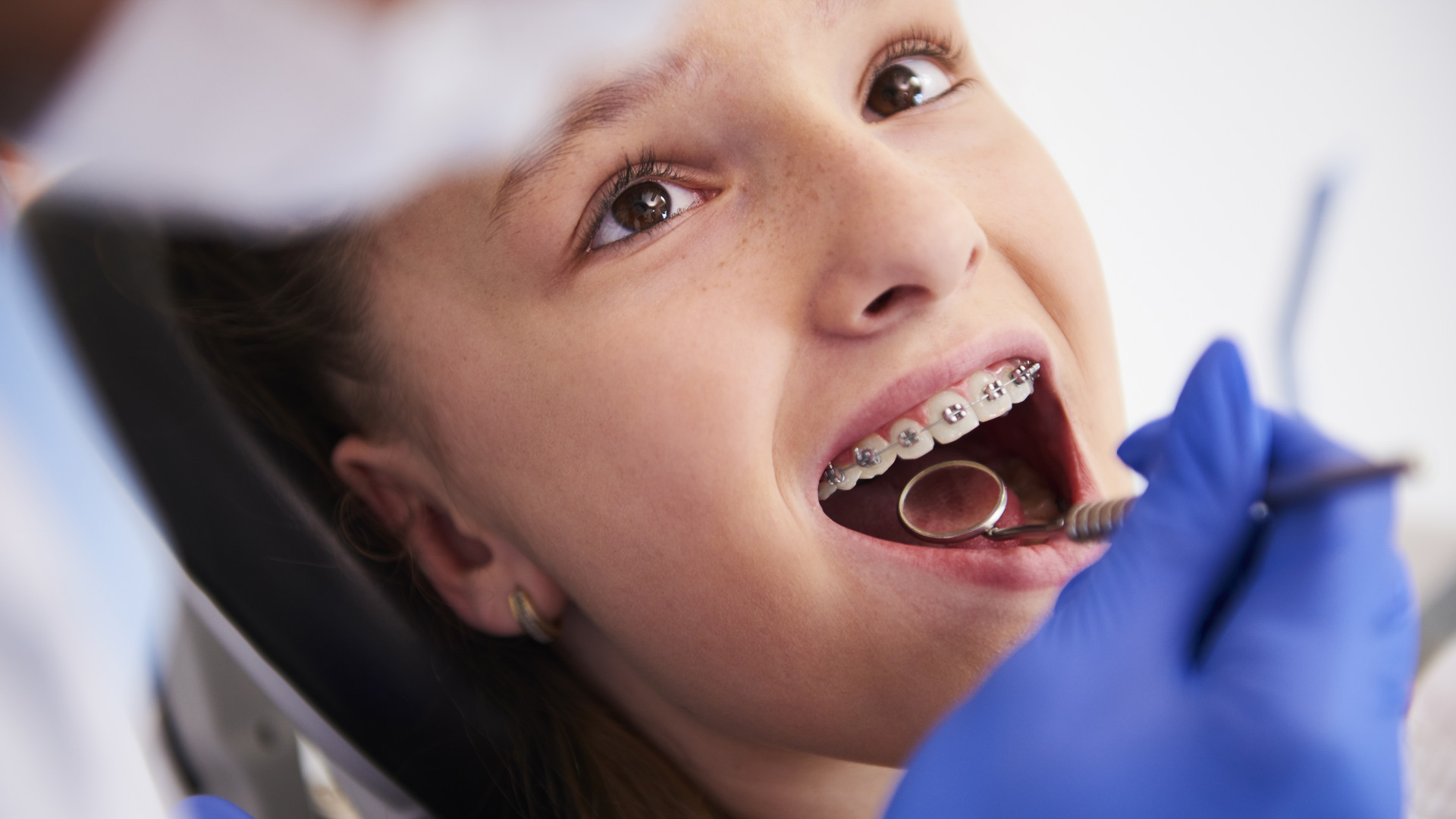 Mutuelle orthodontie : quelles garanties privilégier pour une prise en charge optimale ?